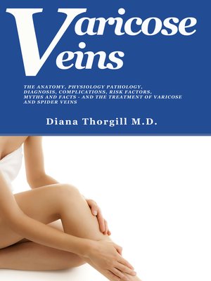 cover image of Varicose Veins
